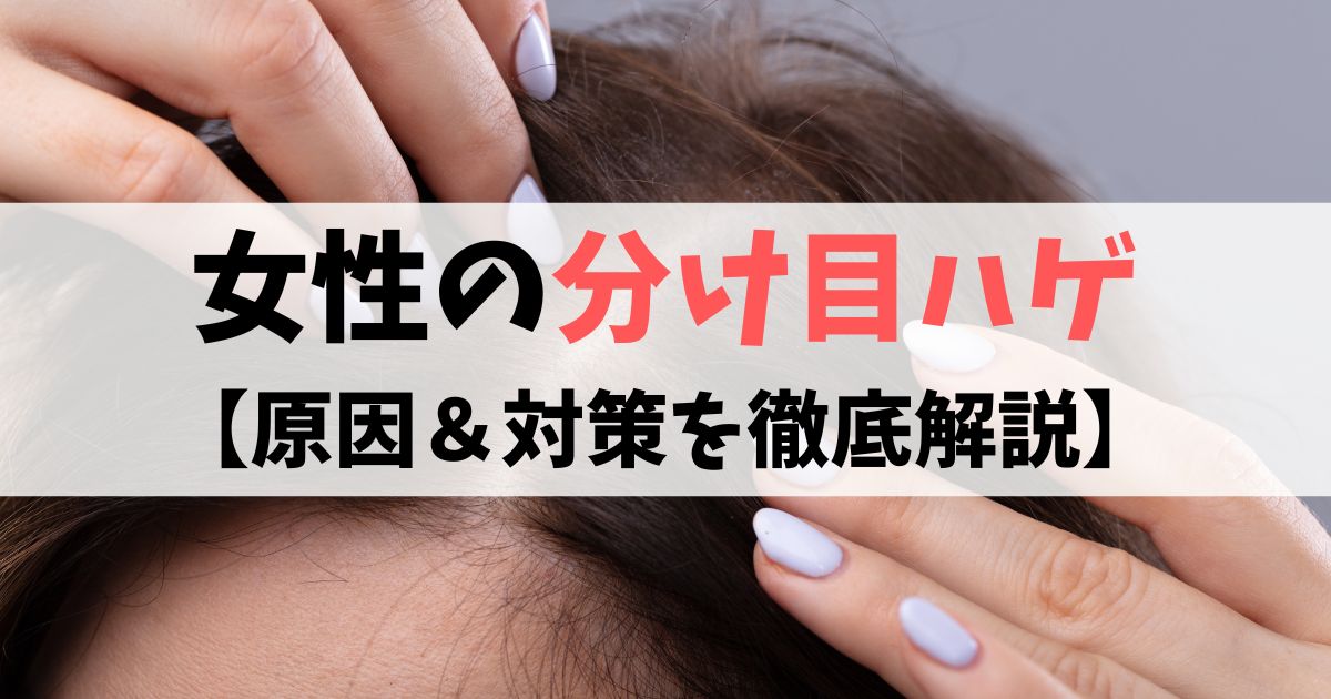 女性が分け目ハゲになる原因と効果的な対策とは 公式 スーパースカルプ発毛センター寝屋川枚方店