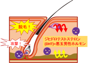 AGA特徴原因解説図2