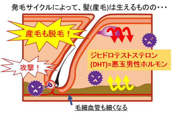 AGAの特徴原因解説図3