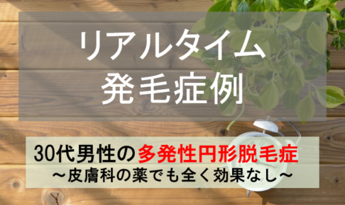 多発性円形脱毛