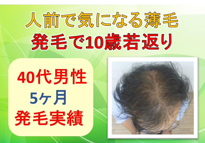 40代男性 人前に立つと気になる薄毛 見た目も気持ちも10歳若返り 公式 スーパースカルプ発毛センター寝屋川枚方店