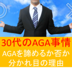 30代のAGA