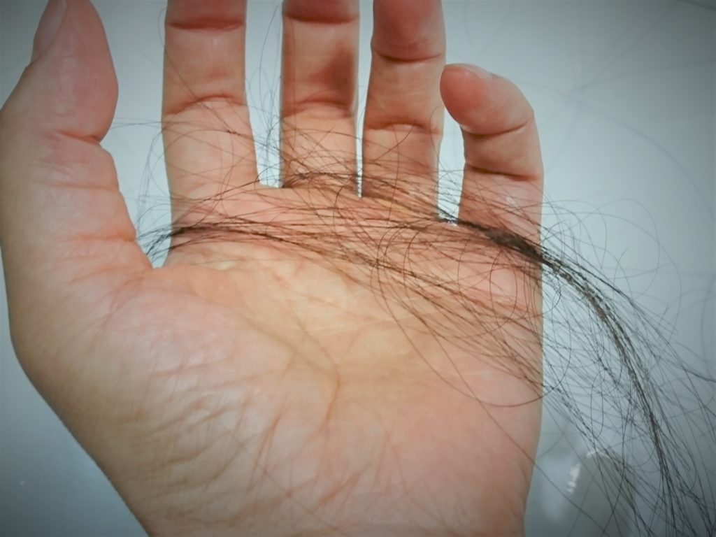 女性の薄毛の原因抜け毛