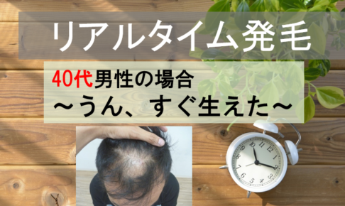 発毛実績40代