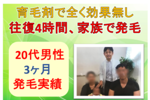 20代男性の薄毛改善