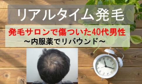 発毛サロンで傷ついた40代男性