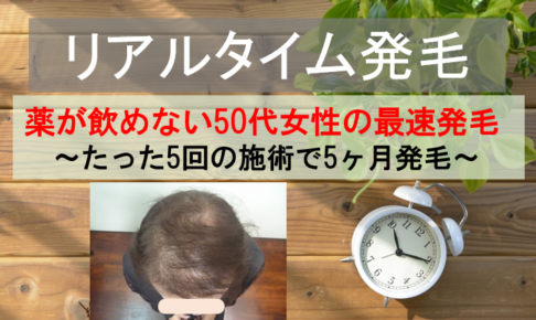50代女性の発毛実績