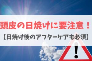 頭皮の日焼けの原因は？