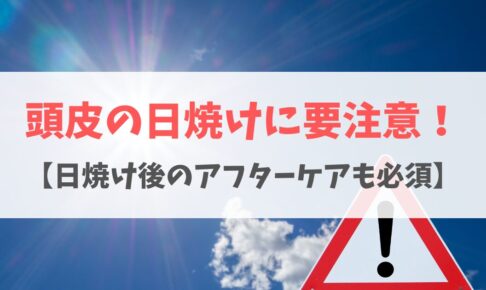 頭皮の日焼けの原因は？