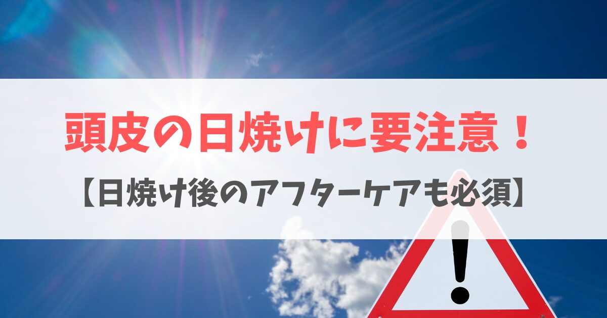 頭皮の日焼けの原因は？