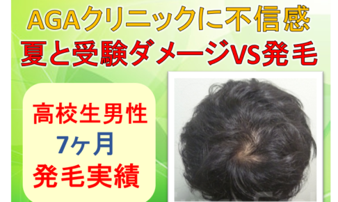 高校生発毛