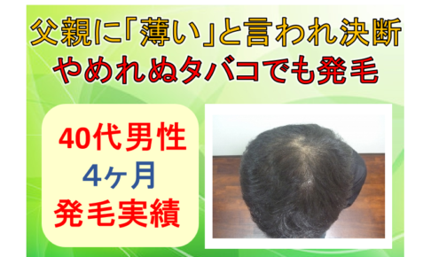 男性の発毛実績まとめ 年代別に薄毛改善の発毛症例をまとめました 公式 スーパースカルプ発毛センター寝屋川枚方店