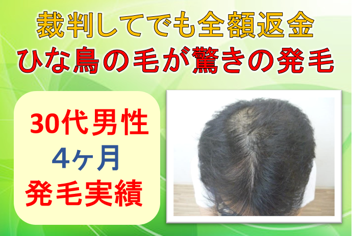 30代男性 裁判になってでも全額返金してもらう ひな鳥のような毛が驚きの発毛 公式 スーパースカルプ発毛センター寝屋川枚方店