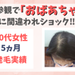 50代女性発毛実績