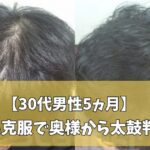 30代男性の5カ月の前頭部薄毛改善