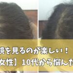 30代女性の薄毛改善