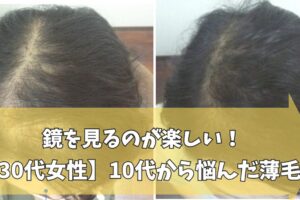 30代女性の薄毛改善