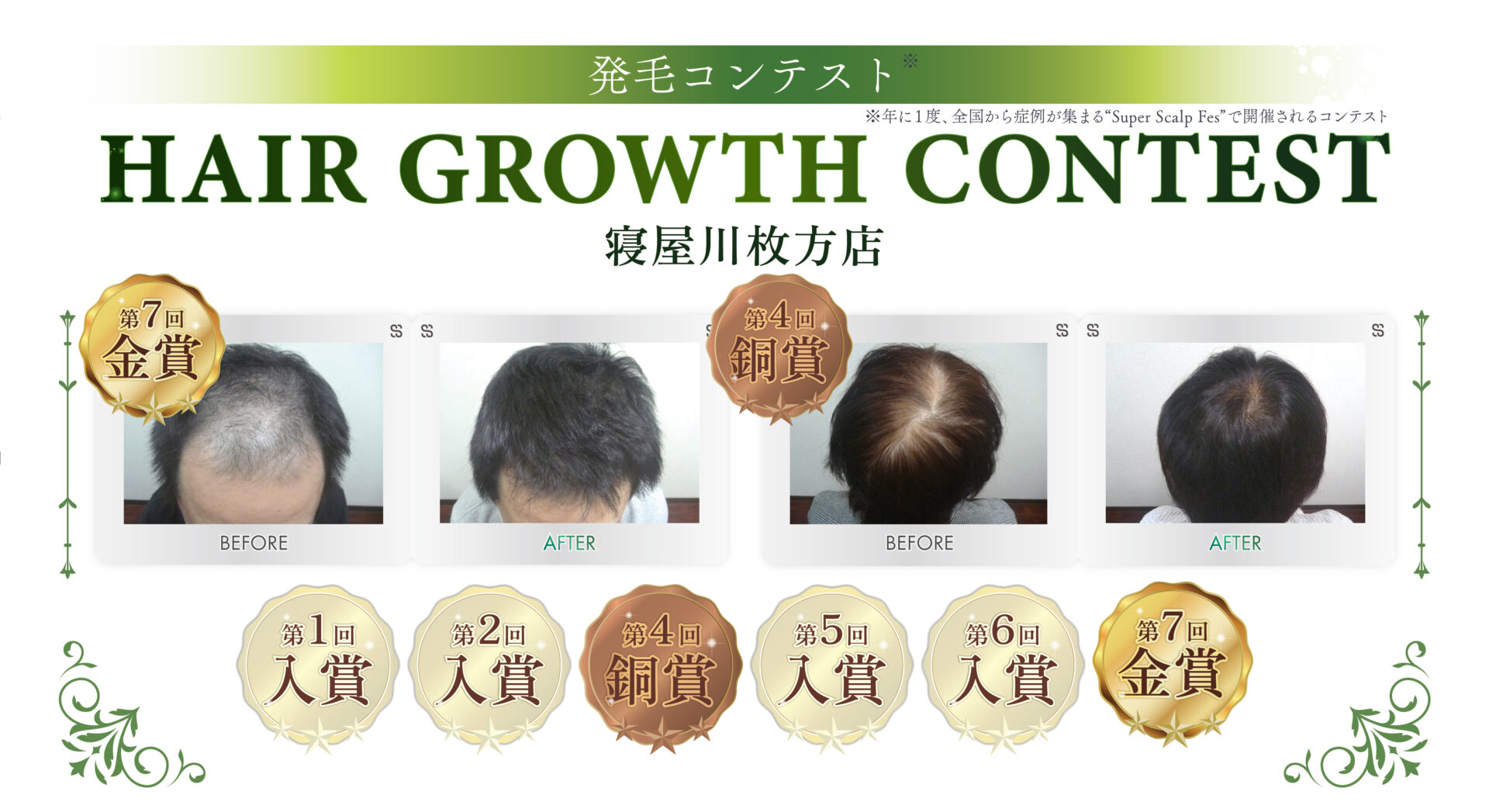 発毛コンテストの実績、第7回金賞、第4回胴賞