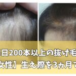 60代女性の生え際の発毛