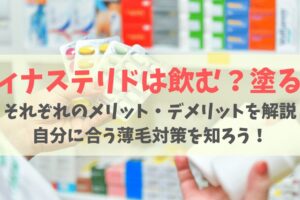 【外用薬vs内服薬】フィナステリドは飲む?塗る?効果の違いや購入方法まで徹底比較!