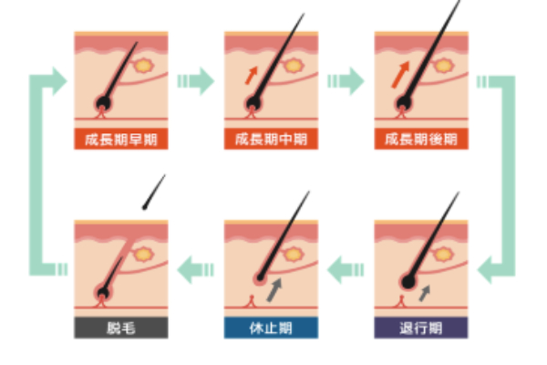 DHTが抜け毛・薄毛を進行させるメカニズム