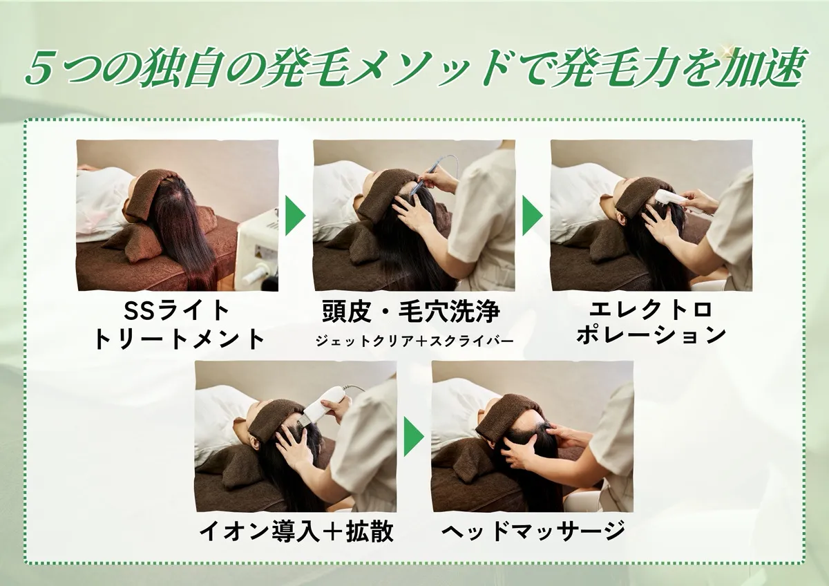5つの独自の発毛メソッドで発毛力を加速